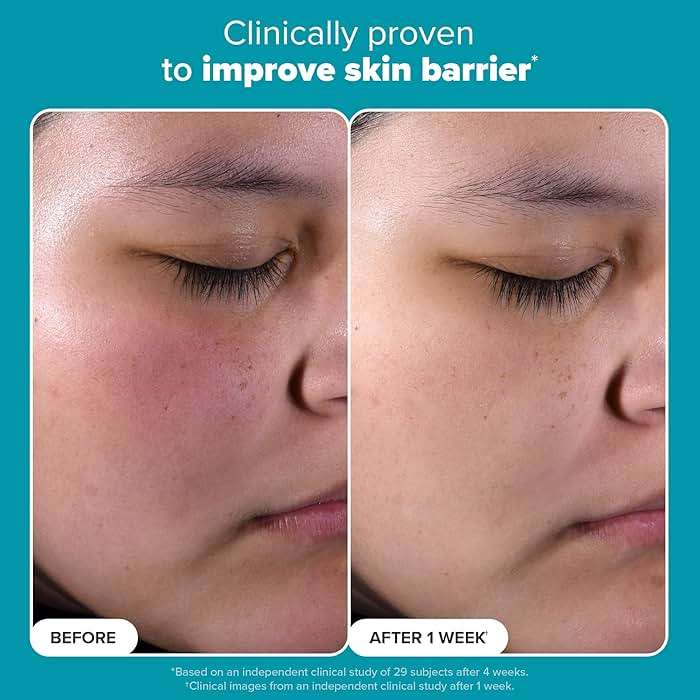 Paula's Choice SKIN PERFECTING 2% BHA Liquid Exfoliant with Salicylic Acid, Facial Polish for Enlarged Pores, Wrinkles & Fine Lines, Suitable for Blackhead-Prone Skin, Fragrance-Free - Image 5