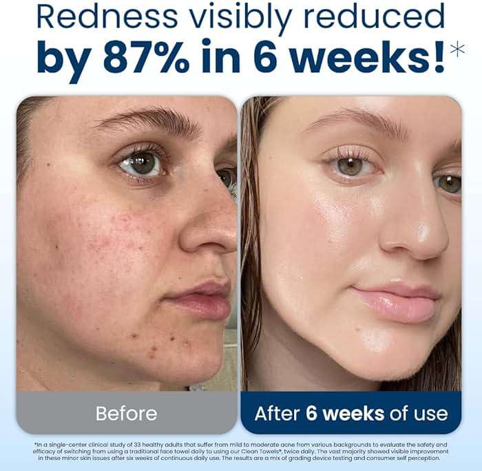 Clean Skin Club Clean Towels XL®, 100% USDA Biobased Face Towel, Disposable Face Towelette, Eczema Association Accepted, Makeup Remover Dry Wipes, Ultra Soft, 1 Pack, 50 Ct - Image 3