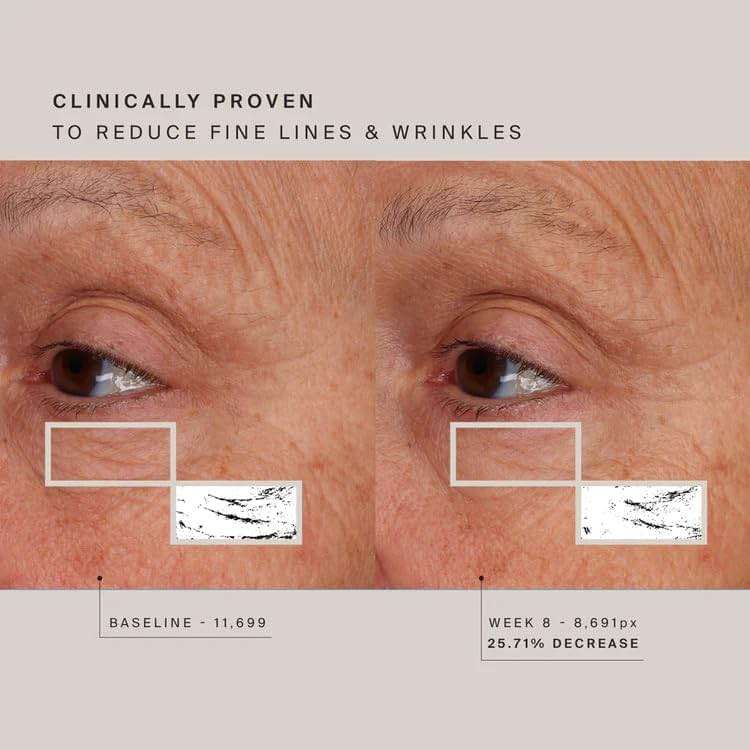 HigherDOSE Red Light Face Mask - FDA Cleared LED Red Light Therapy for Face with Near Infrared Technology - At-Home Facial Device to Improve Fine Lines, Wrinkles, Hydration & Redness for Glass Skin - Image 6