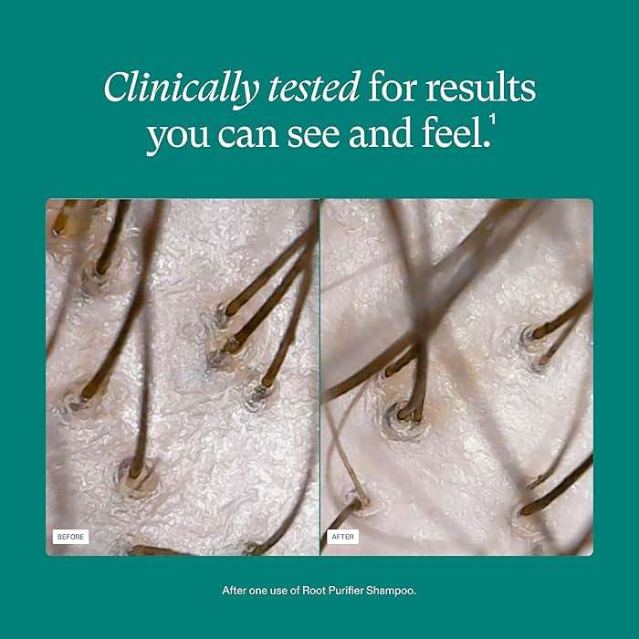 Nutrafol Shampoo, Cleanse and Hydrate Hair and Scalp, Improves Hair Volume, Strength and Texture, Physician-formulated for Thinning Hair, Color Safe, Sulfate Free - Image 4